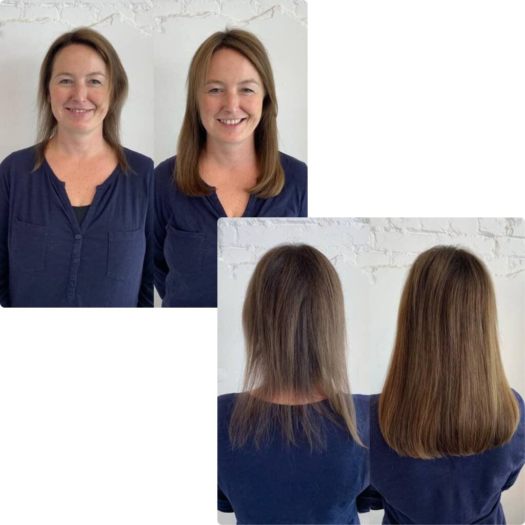 Front and back hair extension transformations on thinning hair