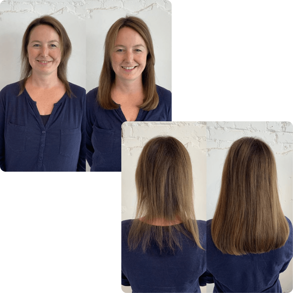 Thinning Hair Transformation Thinning Hair Transformation With Extensions