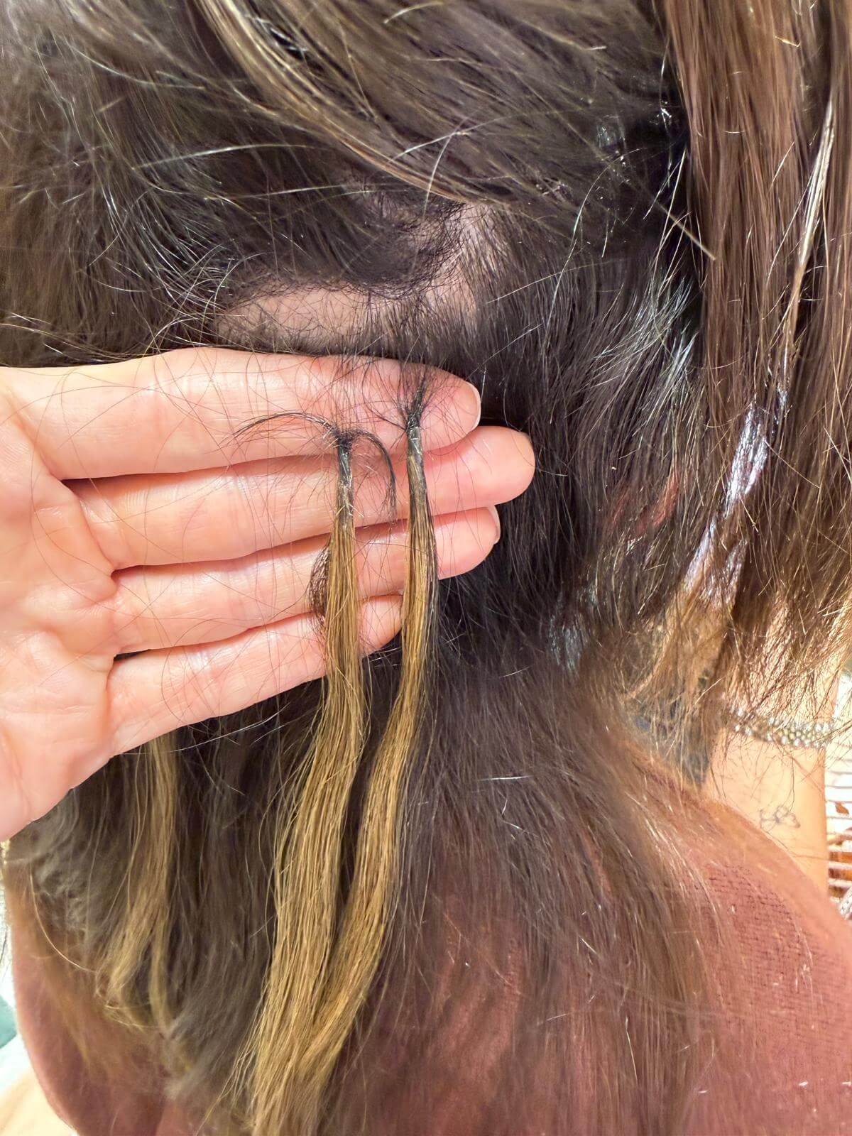 Hair extension damage showing breakage and thinning at the roots caused by incorrectly fitted extensions