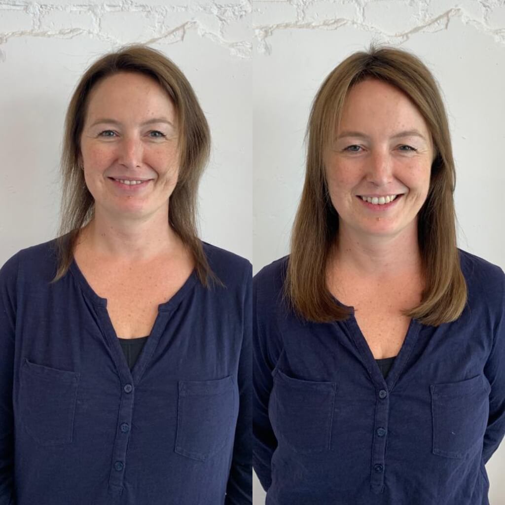 Hair extensions for thinning hair transformation